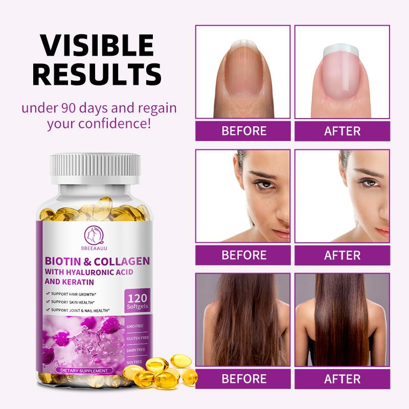 Biotin&Collagen With Hyaluronic Acid And Keratin Capsules Supplement